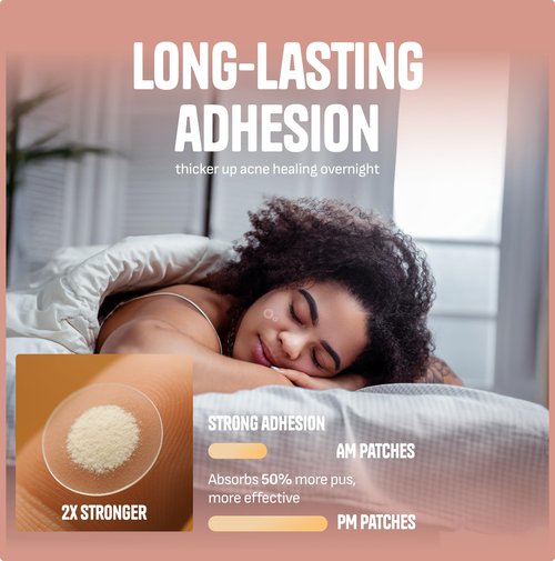 GoGleefy Pimple Patches for Face – Day & Night Acne Patches for Fast Healing, Skin Clarity – Invisible Hydrocolloid Patches, Waterproof Spot Treatment – All Skin Types Zit Patches of 60/120/180