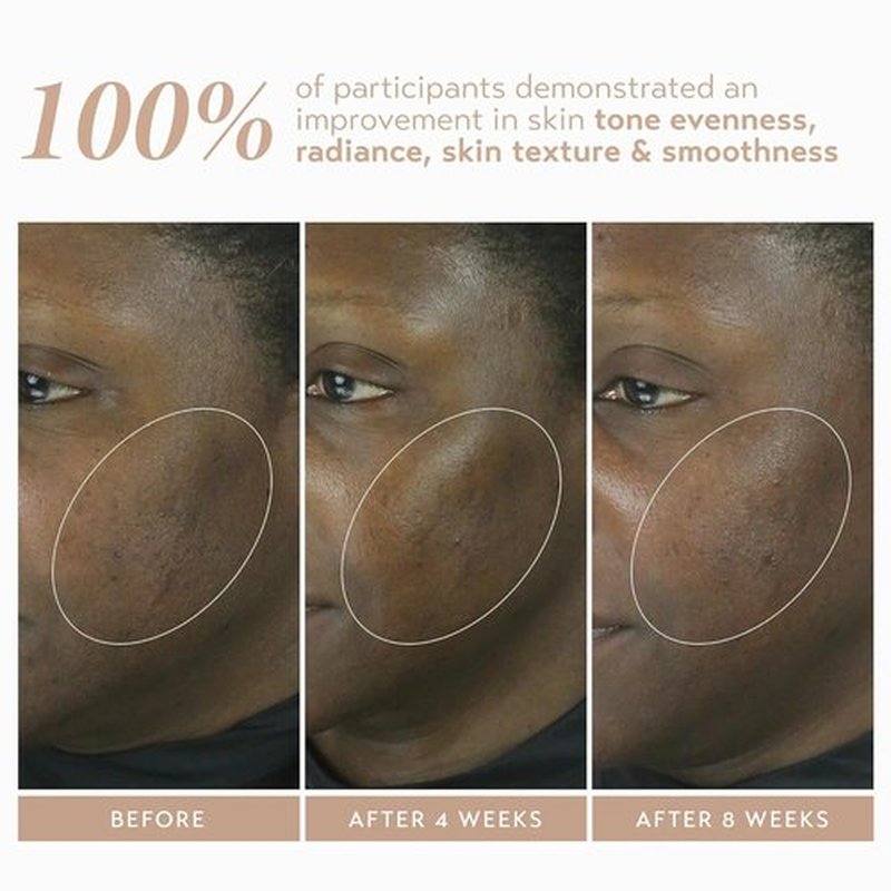 SHANI DARDEN SKIN CARE Retinol Reform Serum - 1% Encapsulated Retinol for Youthful Skin | 1 fl oz
