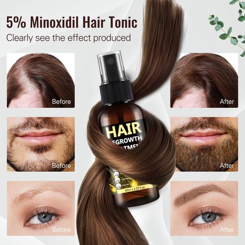 5% Minoxidil for Men & Women, Advanced Formula Hair Regrowth Spray and Topical Solution for Thinning Hair and Beard, Long-Lasting Results