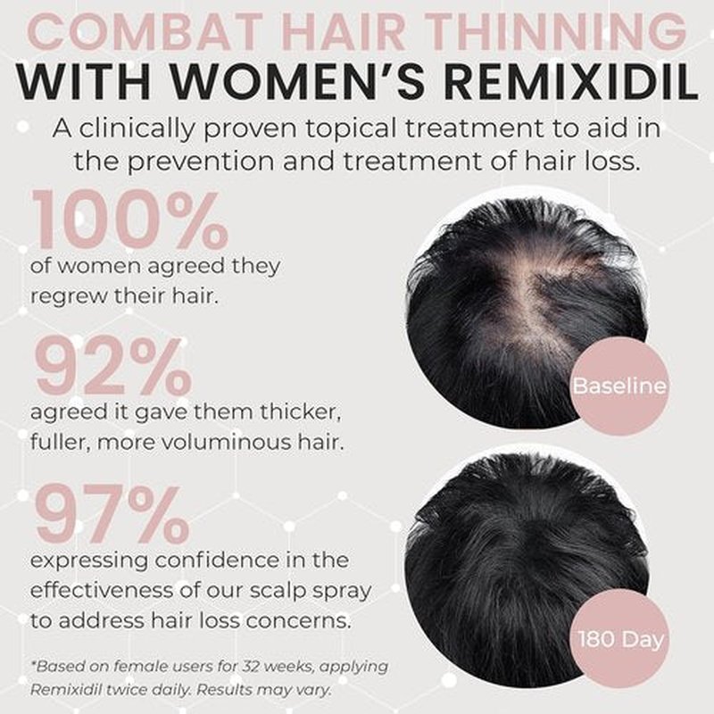 Minoxidil 2% Hair Regrowth Spray for Women - Clinically Proven Thicker & Fuller Solution | 60 ml