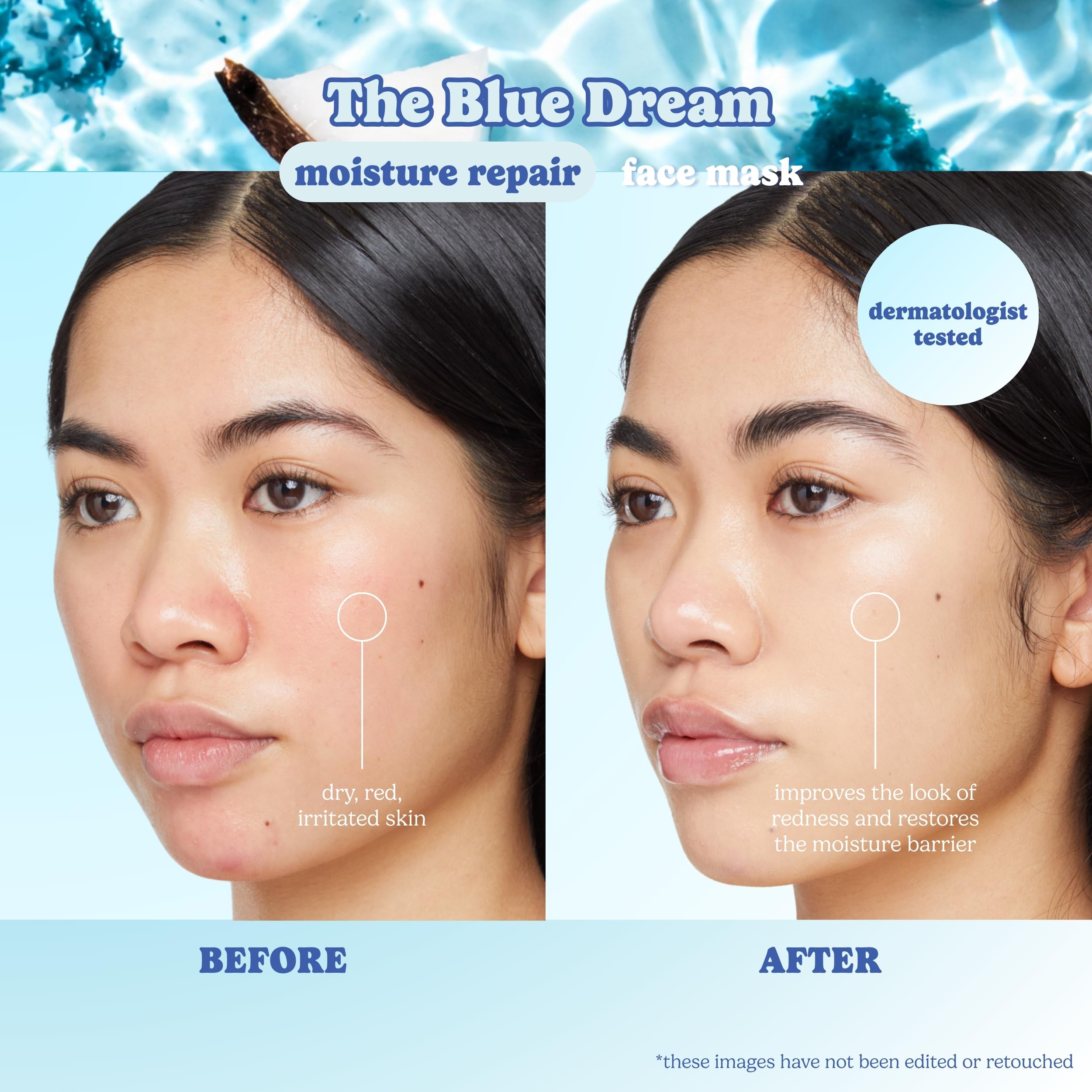 ESW Beauty The Blue Dream Moisture Repair Korean Face Mask (6-Pack) – Vitamin C, Centella, Hyaluronic Acid & Blue Spirulina for Sensitive Skin & Hydration – Skincare Gifts for Women