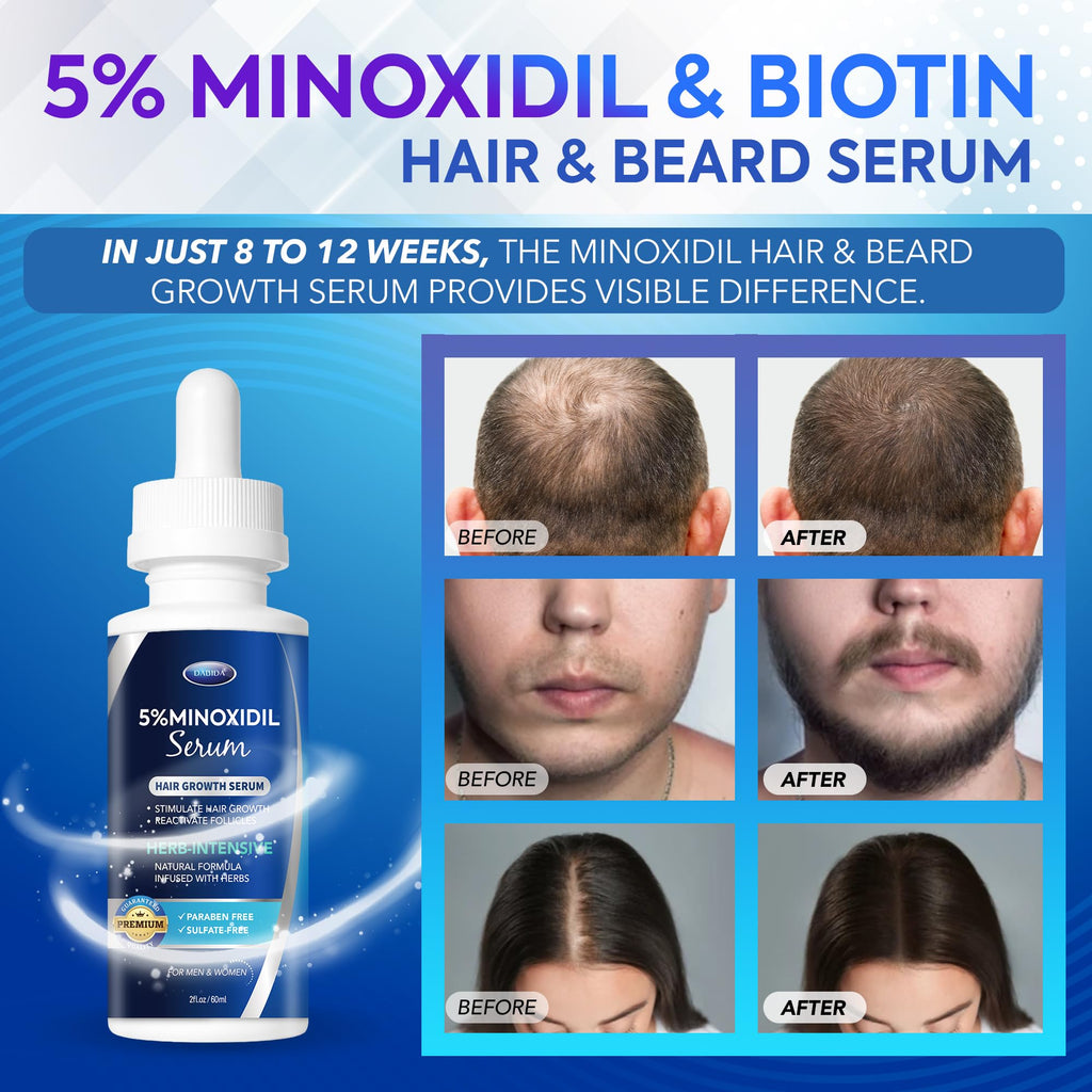 5% Minoxidil Hair Growth for Men and Women: Extra Strength Beard Regrowth Treatment Serum with Minoxidil and Biotin for Thinning Hair Loss to Grow Thicker Fuller Hair 60ml 4 Bottles
