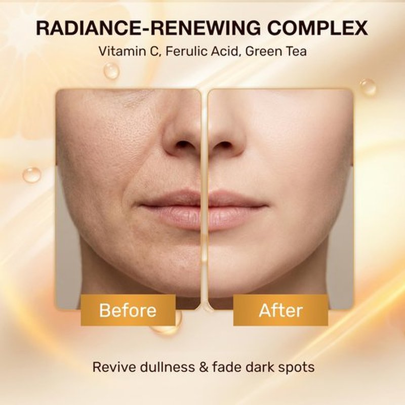 Lodbar Retinol Serum For Face,Bakuchiol Retinol Rejuvenation Advanced Anti-aging Face Serum With Bakuchiol, Niacinamide, Vitamin C, Gentle, Fast-absorbing Formula For Smoother,Brighter & Hydrated Skin