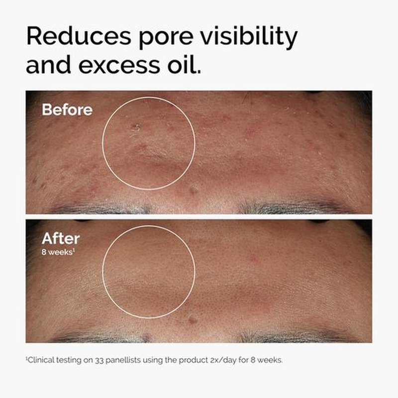 The Ordinary Serum Favorites Set - Hydrating Hyaluronic Acid 2% + Niacinamide 10% + Caffeine Solution | Eye & Face Care