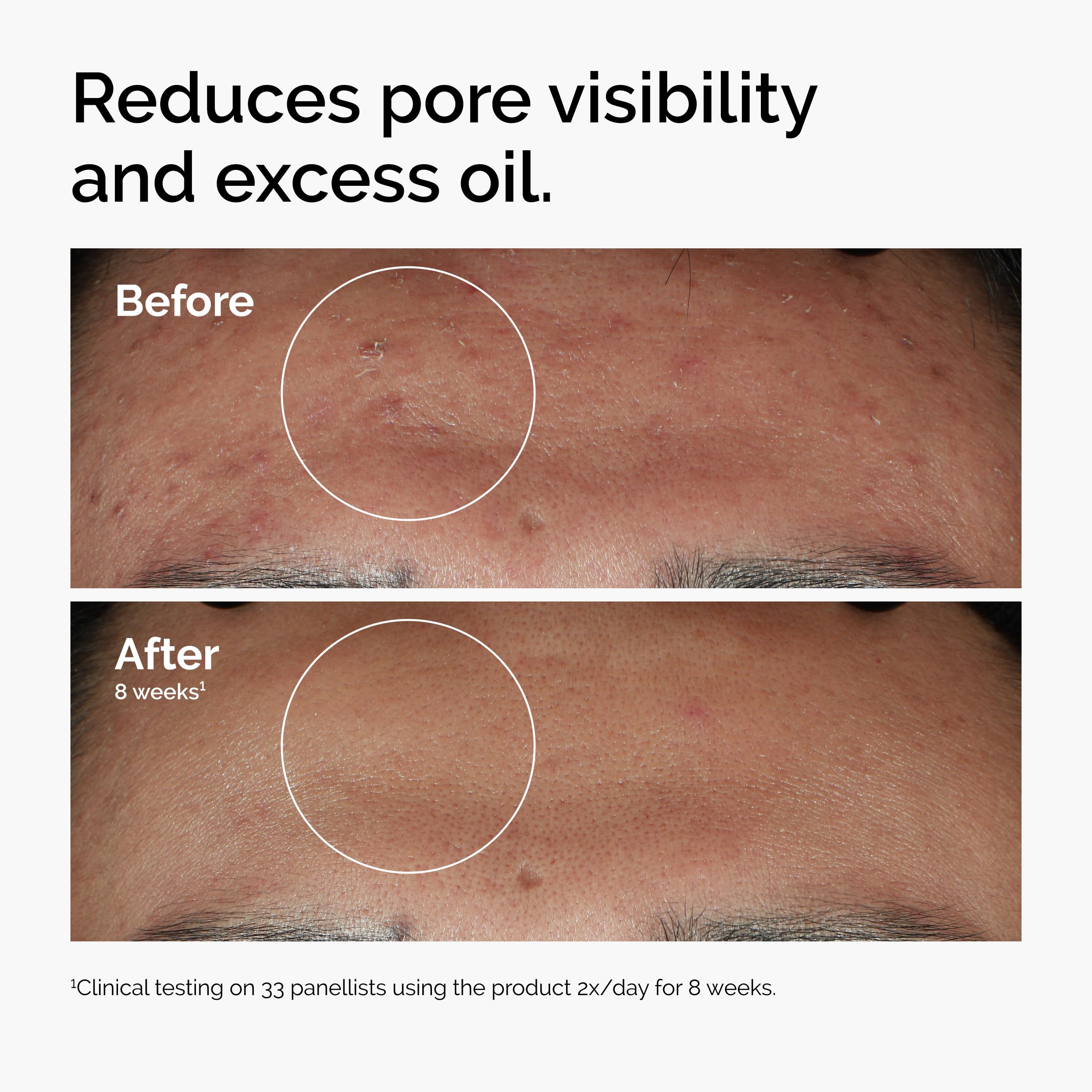 The Ordinary Serum Favorites Set – Hyaluronic Acid 2% + B5, Niacinamide 10% + Zinc 1%, Caffeine Solution 5% + EGCG Eye Serum, Serums for Hydrating, Brightening & Pore-Minimizing Skin Care