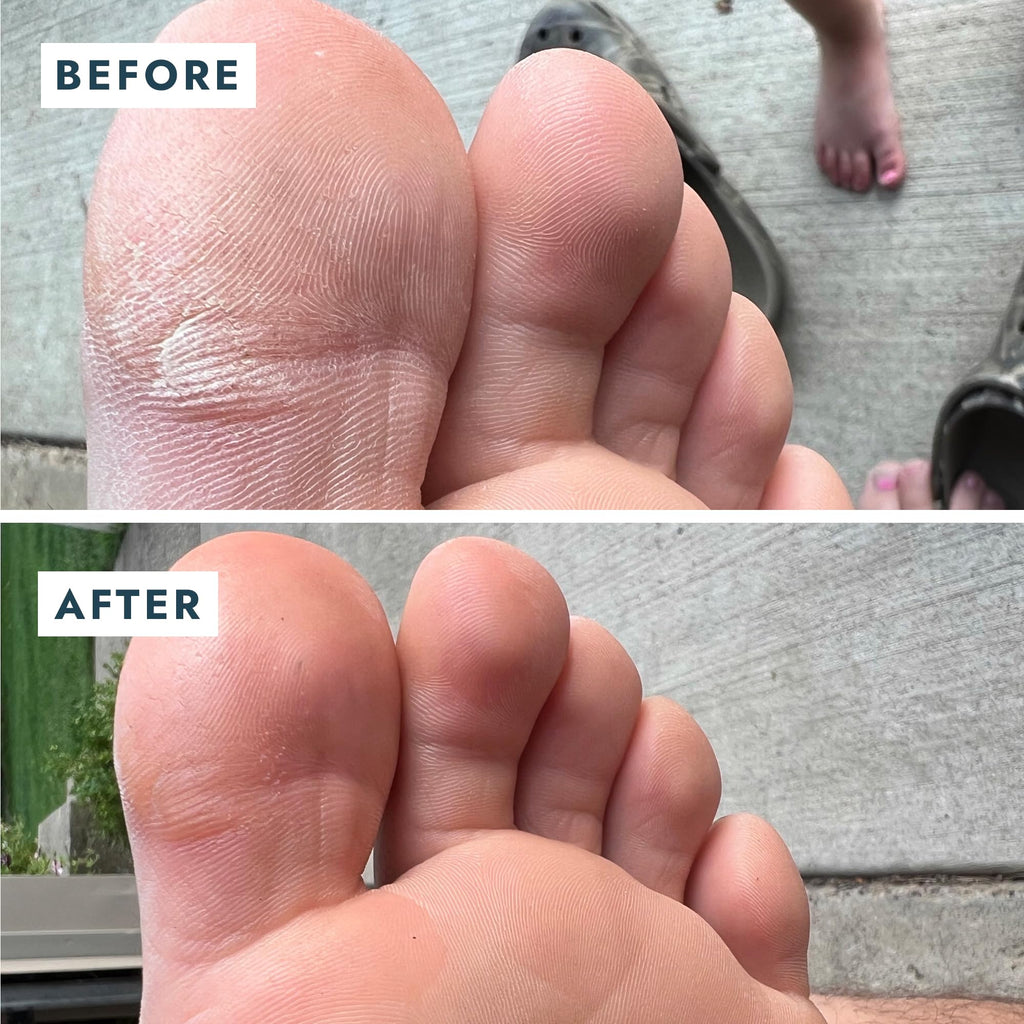 VOESH Solemate Heel Repair Balm, Heel Moisturizer & Repair, Balm for Rough and Cracked Heels, Foot Care