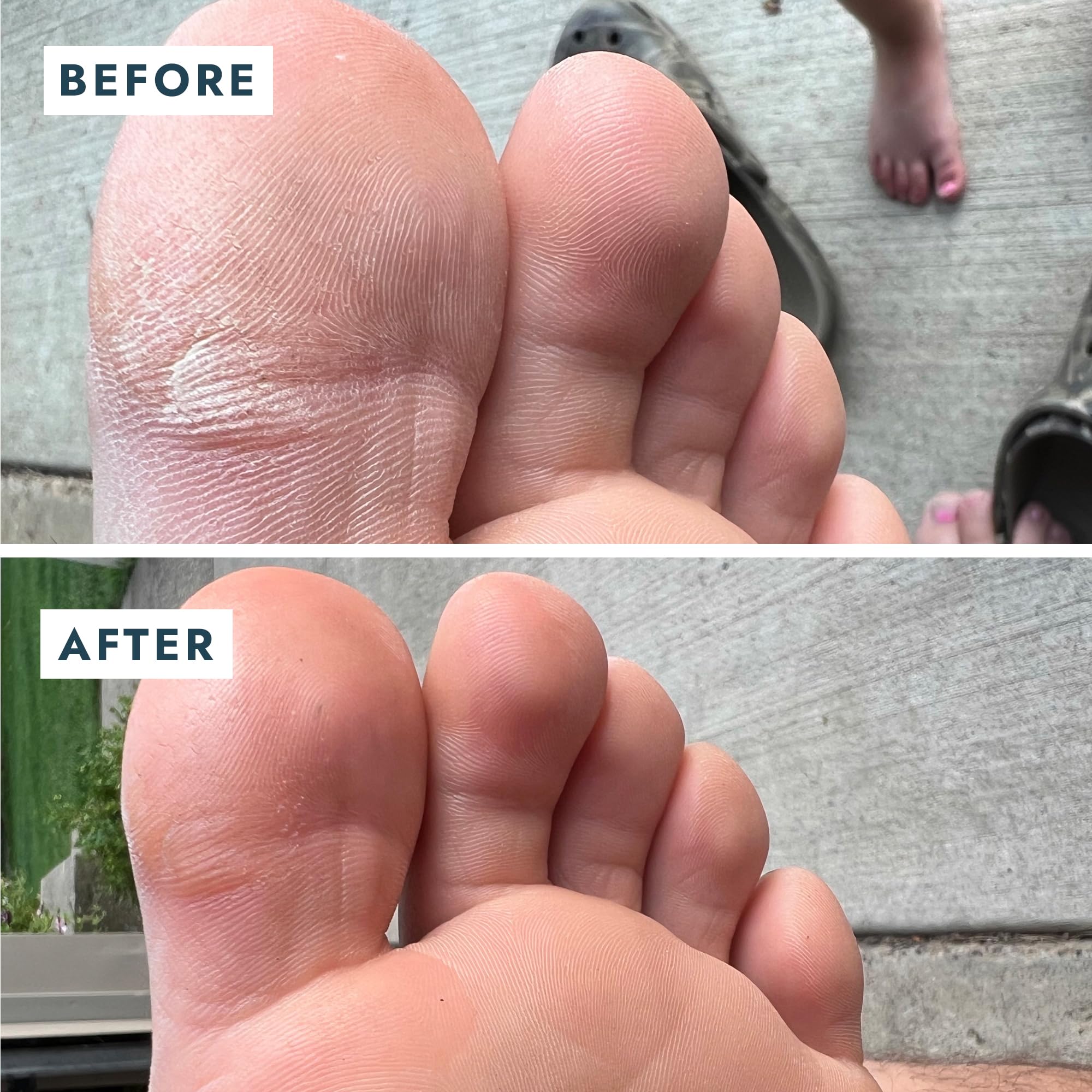 VOESH Solemate Heel Repair Balm, Heel Moisturizer & Repair, Balm for Rough and Cracked Heels, Foot Care