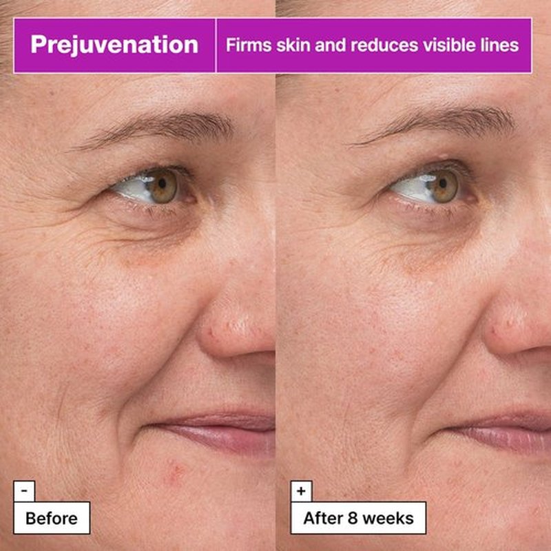 Dr.Jart+ Prejuvenation Firming Bakuchiol Serum with Collagen Peptides | Korean Anti Aging Serum | Sensitive Skin Friendly | Korean Skin Care, 1.69 Fl Oz
