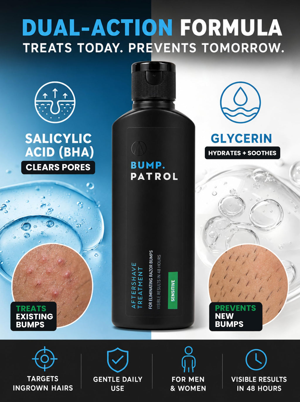 Bump Patrol Sensitive Strength Aftershave Treatment Serum – Razor Bump Stopper and Ingrown Hair Treatment for Men and Women, Alcohol Free Ingrown Hair Serum for Sensitive Skin