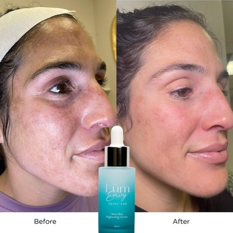 LumEnvy Salmon DNA Glass Skin Serum - Hydrating Korean Skincare Face Serum with PDRN, Niacinamide & Centella Asiatica | Brightening, Dry Skin, Anti-Aging, Dark Spots & Wrinkles | 30ml