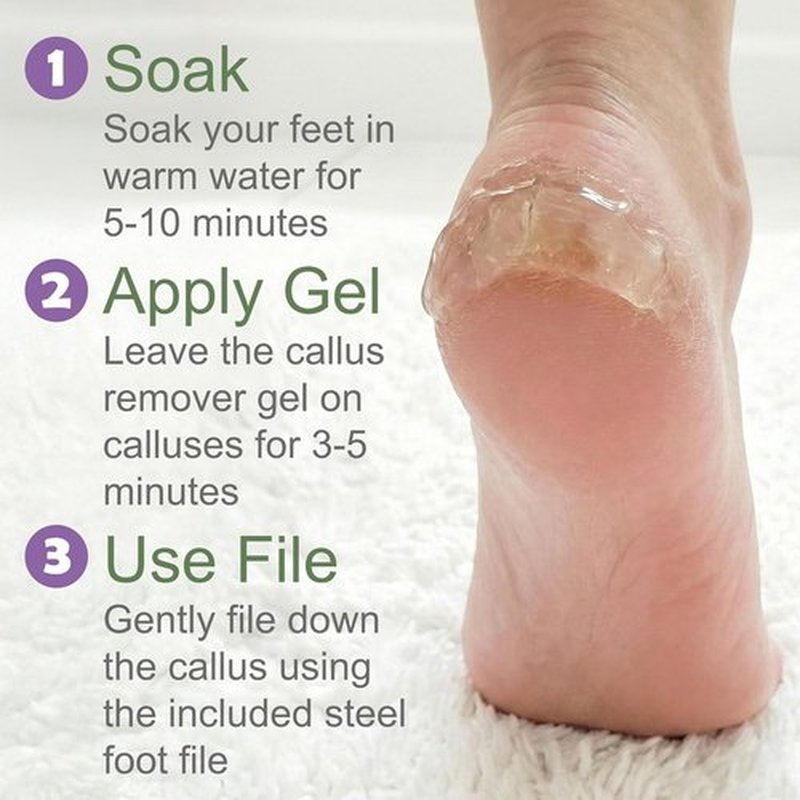 Skiennix Callus Remover Gel - Extra Strength 8 oz Foot Care with Double-Sided File & Spa Kit