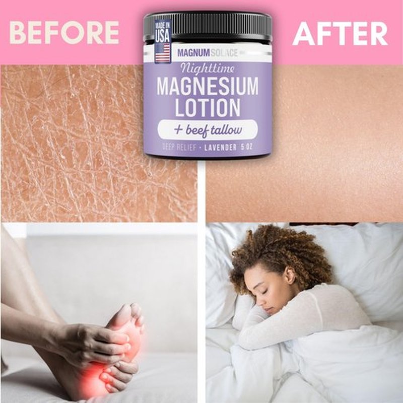 Magnum Solace Nighttime Magnesium Lotion with Beef Tallow – Soothing Relief for Muscles & Joints – Highly Concentrated – Apply to Legs or Feet Before Bed, Lavender
