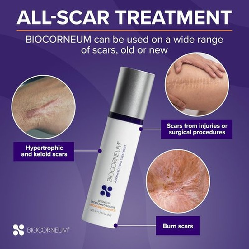 Silishield® Advanced Scar Treatment Gel - Silicone Formula with SPF 30 for Surgical & Keloid Scars - 20g, Safe for All Ages, Made in USA