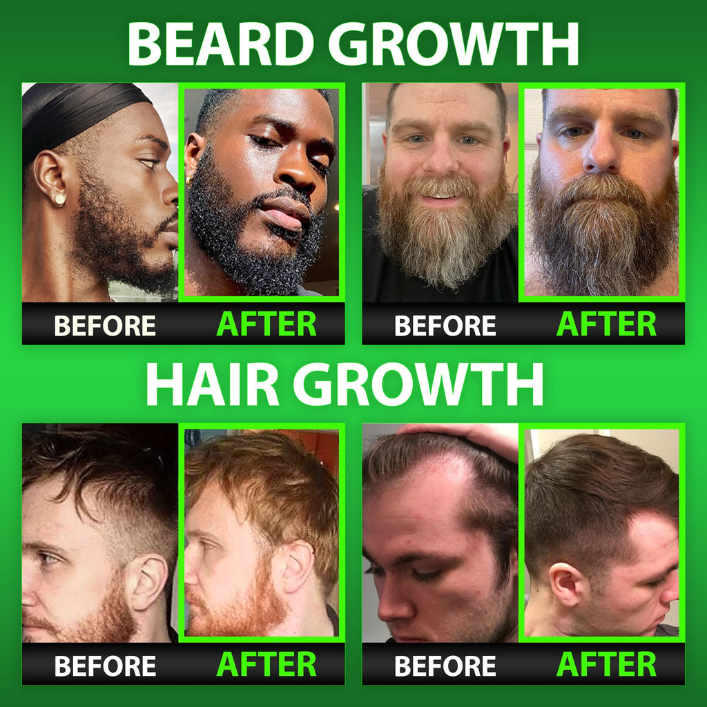 Best Beard Stuff Beard Growth Vitamins - Biotin Gummies for Beard & Hair Growth – Maximum Strength 620,000mcg Biotin with Collagen, MSM, Keratin & Bamboo Extract