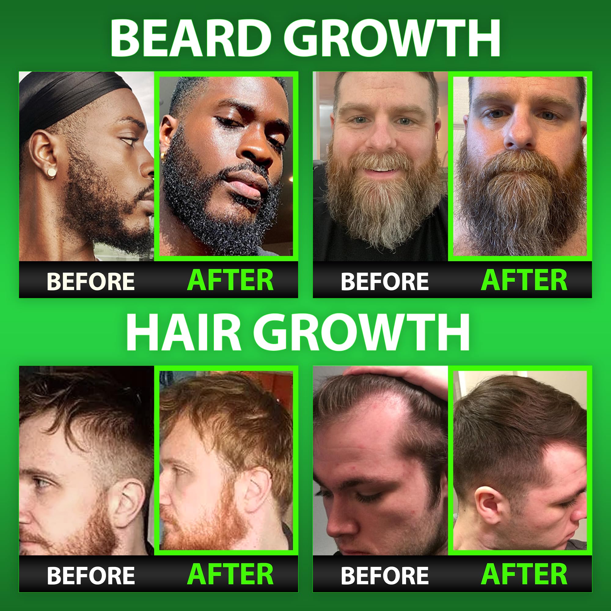 Best Beard Stuff Beard Growth Vitamins - Biotin Gummies for Beard & Hair Growth – Maximum Strength 620,000mcg Biotin with Collagen, MSM, Keratin & Bamboo Extract
