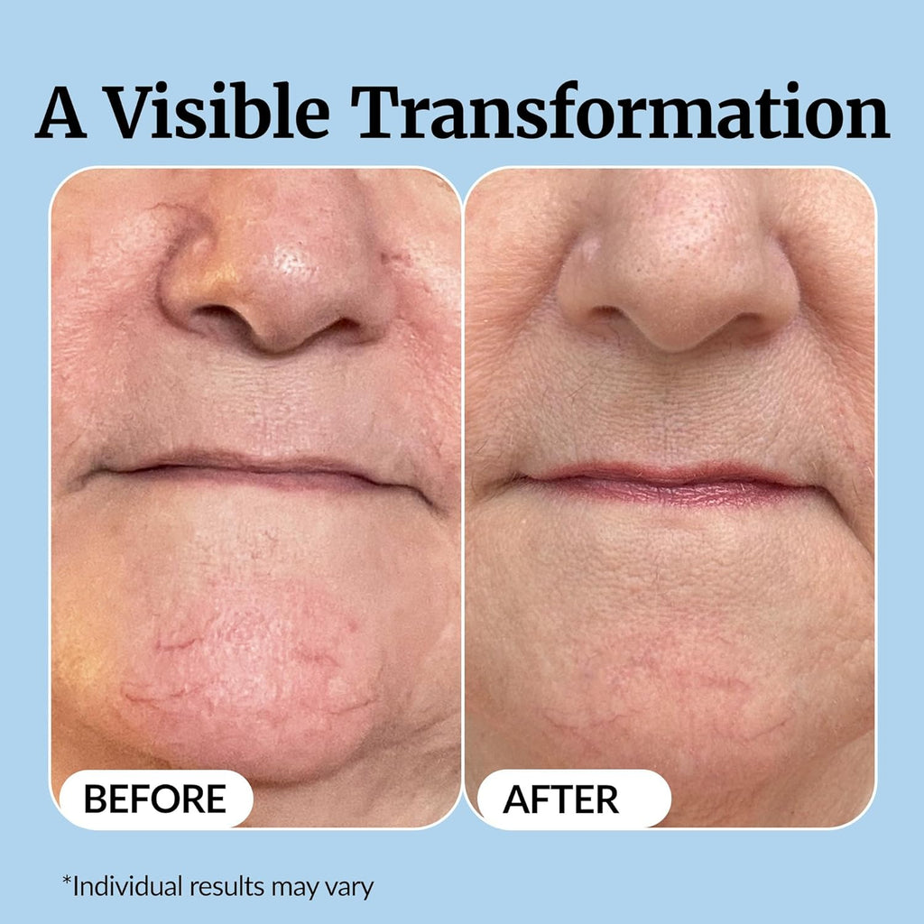 Vibriance Super C Serum - All-in-One Vitamin Formula for Mature Skin | Hydrates, Firms, Lifts, 1 fl oz