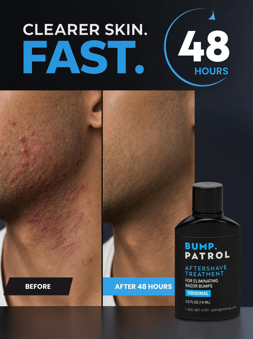 Bump Patrol Original Formula Aftershave Treatment Serum – Razor Bump Stopper and Ingrown Hair Treatment for Men and Women with Salicylic Acid for Razor Burn & Shaving Irritation