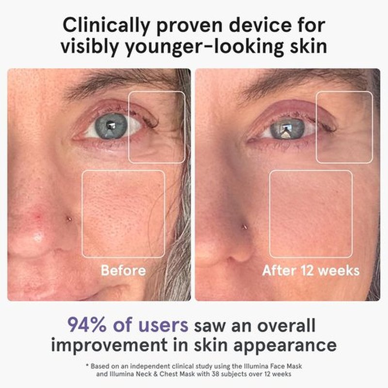iRestore LED Face Mask - Red Light Therapy for Youthful Skin | 360 LEDs for Wrinkles & Dark Spots
