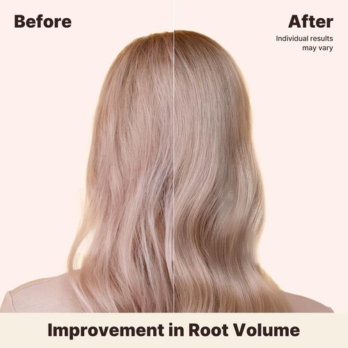 MINOXELL Deep Volumizing Conditioner for Thinning Hair – Korean Hair Care with Biotin & Panthenol – Damage Repair, Elasticity & Strength – White Tea Mandarin Scent, 16.9 fl oz