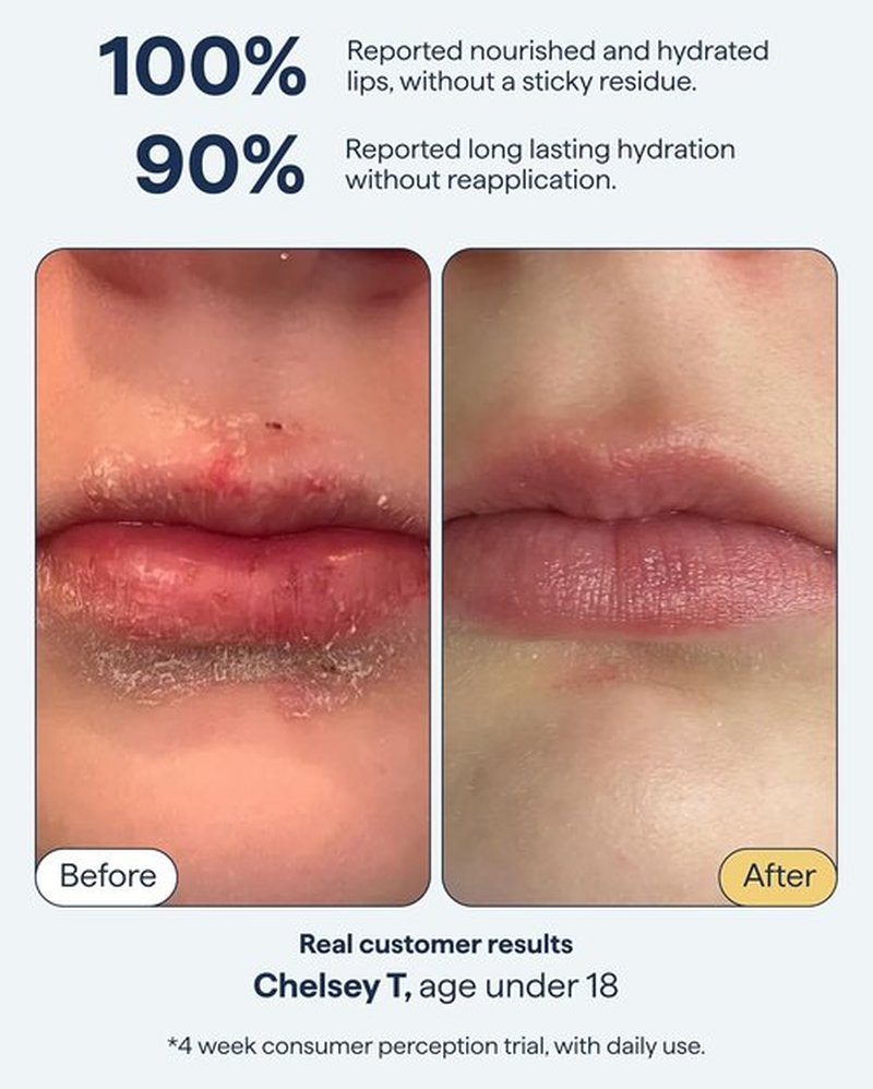 Dr. Shah Lip Balm Ointment - All-In-One Hydrating Treatment with Ceramides & Peptides for Dry, Cracked Lips