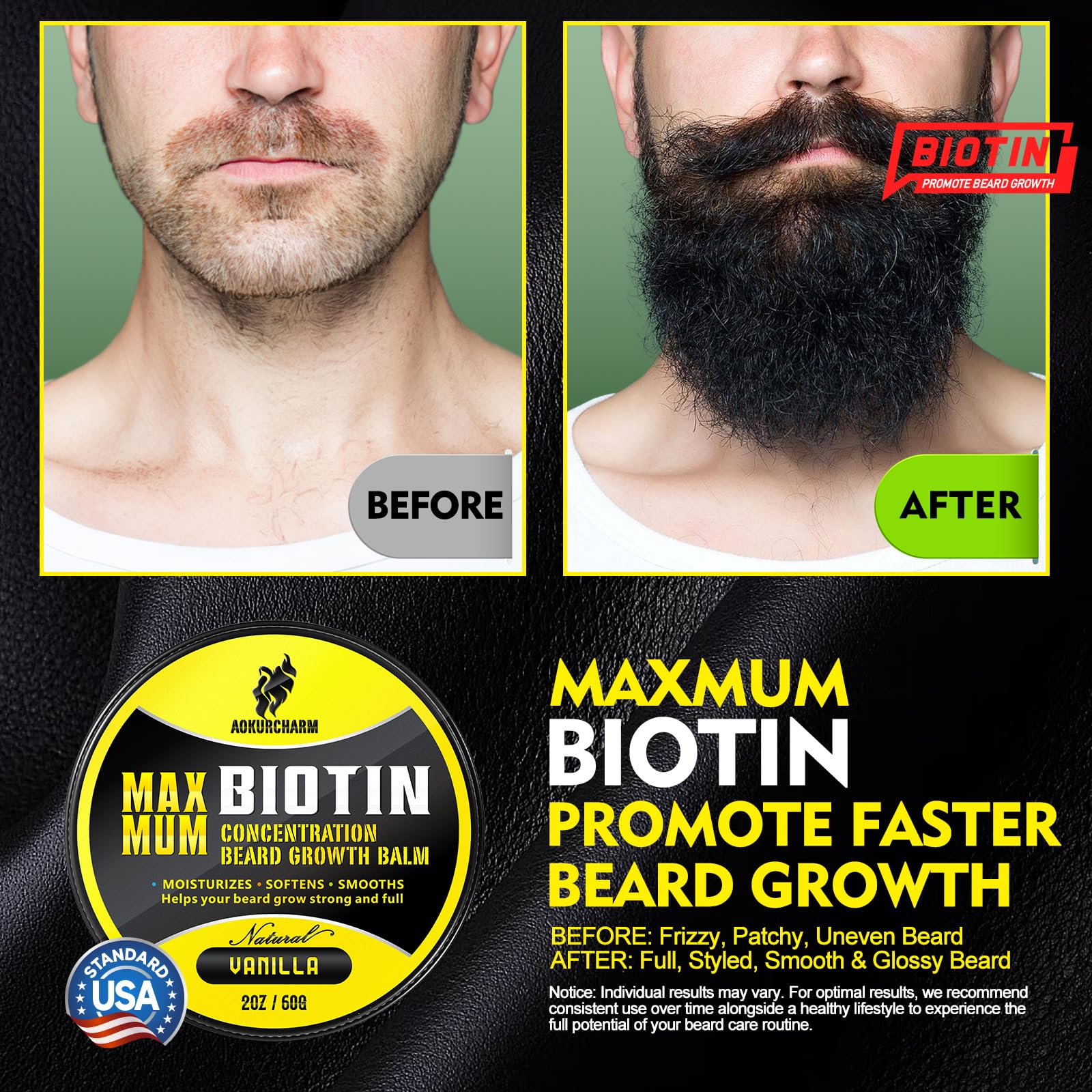 aokur Biotin Beard Balm for Men – Vanilla Beard Balm for Growth & Styling – With Castor Oil, Jojoba & Shea Butter – Softens & Thickens – 2 OZ