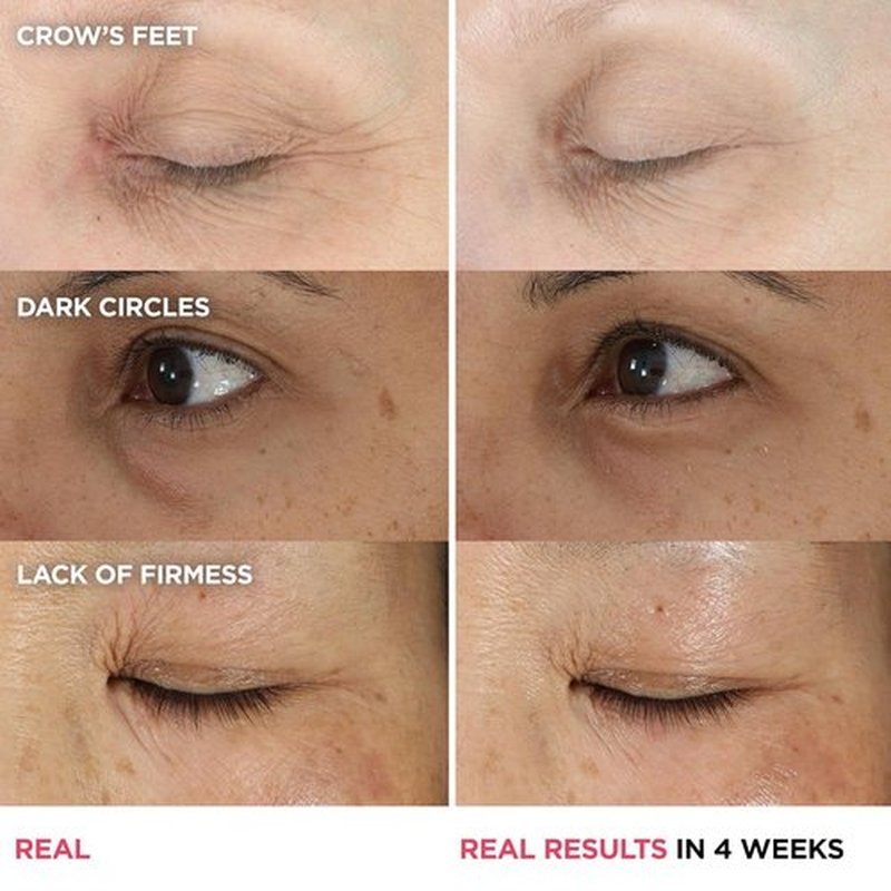IT Cosmetics Confidence in an Eye Cream - Anti-Aging Peptide Formula for Dark Circles & Wrinkles, 48HR Hydration, All Skin Types