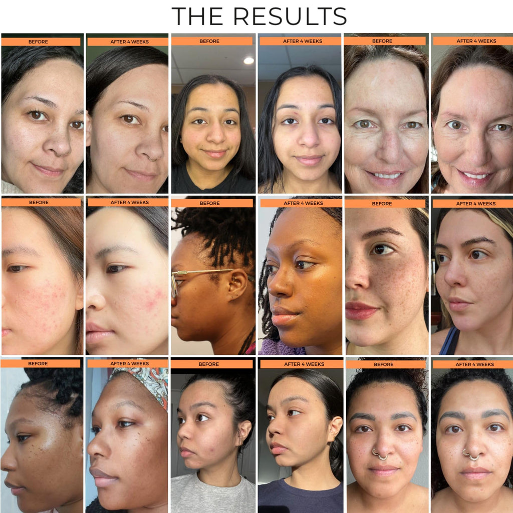BeautyStat Universal C Refiner - 20% Pure Vitamin C Serum For Face, Brightens the Look of Dull Skin & Dark Spots, Minimize the Appearance of Fine Lines & Wrinkles (1.7 oz. / 50ml)