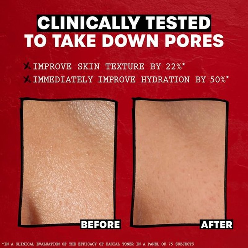 THAYERS Alcohol-Free Rose Petal Witch Hazel Toner - Soothing & Hydrating for All Skin Types | 12oz
