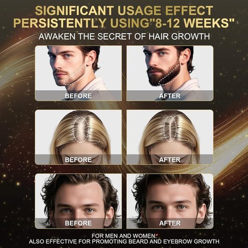 Regine Switzerland 5% Minoxidil Foam - Hair Growth Treatment with Biotin for Thinning Hair | Non-Greasy, Fast Absorbing, 3 Month Supply (3 x 2.12 oz)