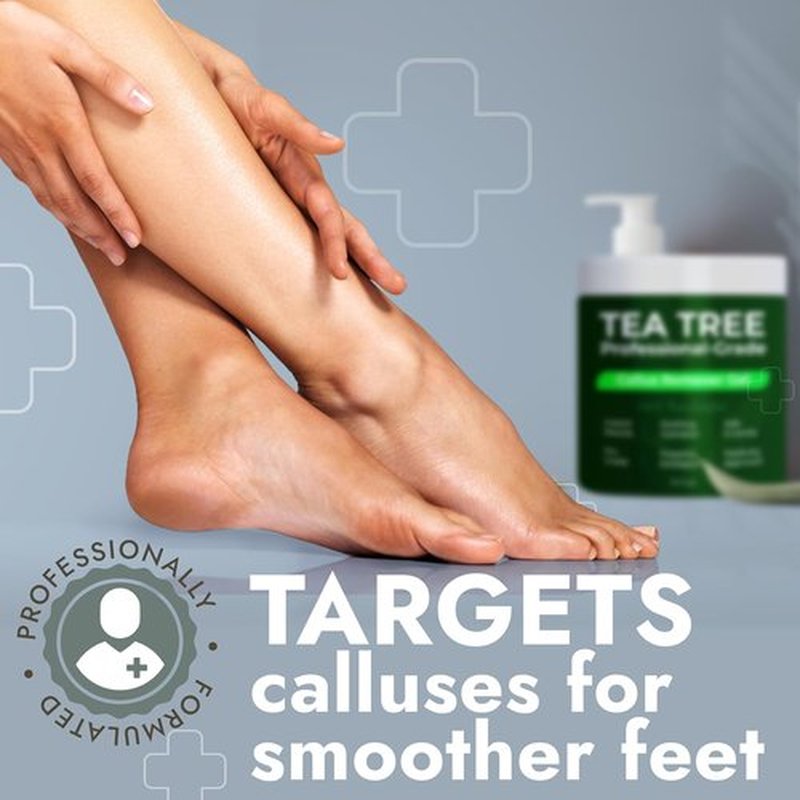 Skiennix Callus Remover Gel - Extra Strength Treatment with Tea Tree Oil | 14 fl oz | 50 Applications + 3 Pumice Stones