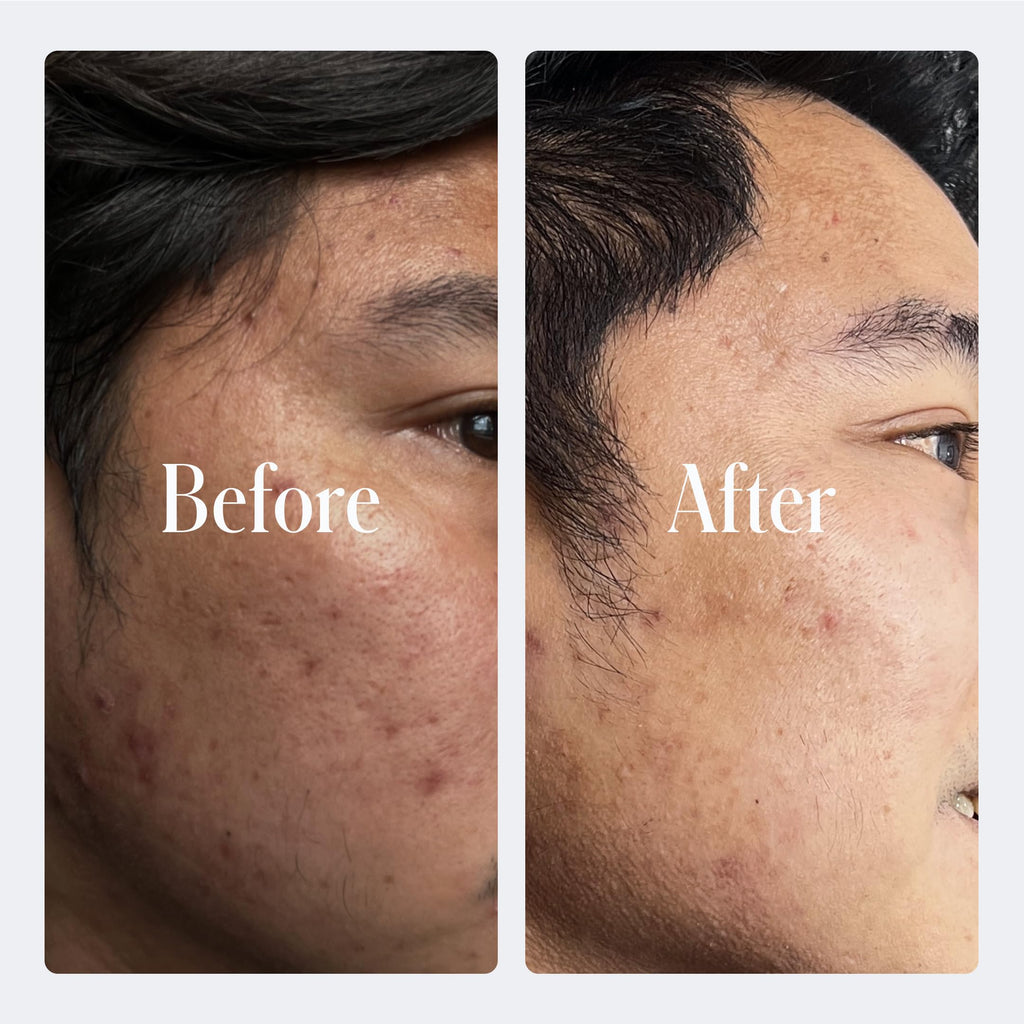 Geologie Retinol Anti-Aging Face Cream | Advanced .3% Retinol Formula for Effective Results | Reduce Fine Lines & Wrinkles | Protect & Repair Skin With Hyaluronic Acid & Niacinamide | For Men & Women