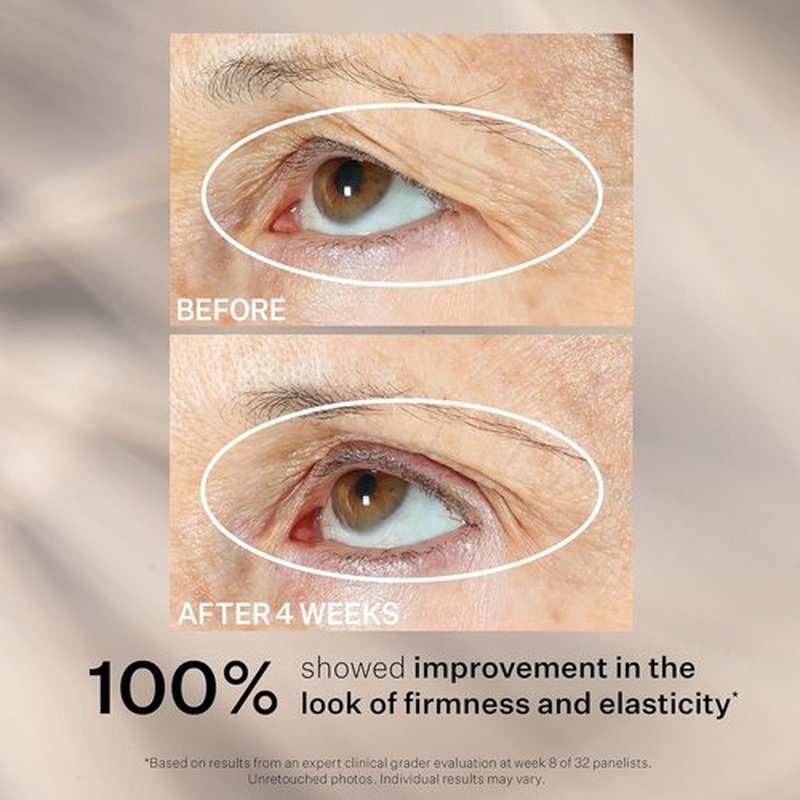 StriVectin Peptight Face Lift Serum - Tightening & Brightening Peptides for Youthful Skin