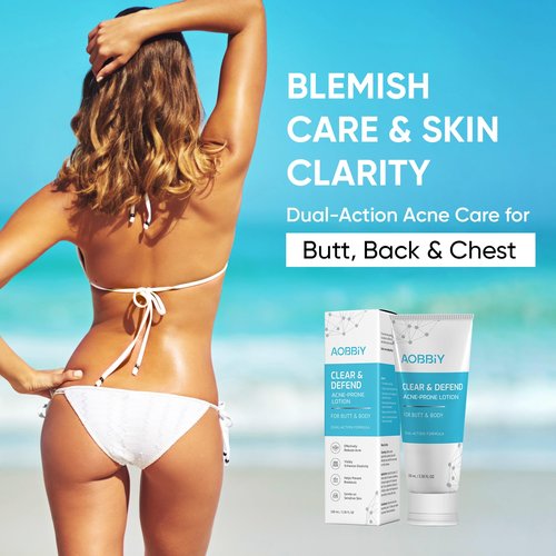 Butt Acne Clearing Treatment Cream: Clears & Prevents Breakouts Fast – Gentle Body & Back Lotion for Clogged Pores, Folliculitis & Bumps, 2% Salicylic Acid & Niacinamide, Ideal for Women, Men & Teens