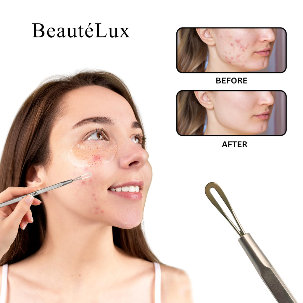 BeautéLux 2-in-1 Blackhead Removal Tool, Stainless Steel Acne Extractor, Blackhead & Whitehead Remover for Face/Nose, Dual-Loop Pimple Extractor, Skin Blemish Tool