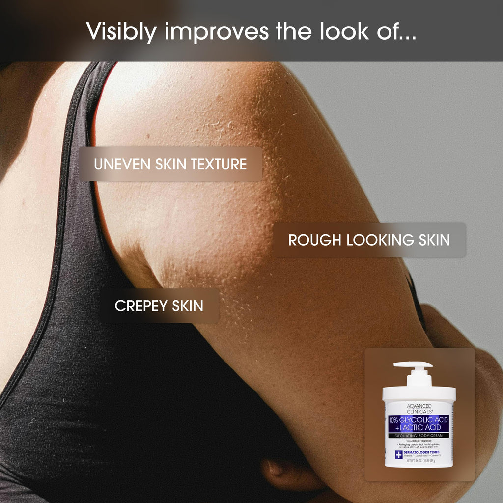 Advanced Clinicals Retinol Body Cream Moisturizer + Exfoliating 10% Glycolic Acid & Lactic Acid Lotion 2PC Skincare Set For Women & Men To Reduce Appearance Of Crepey Skin & Uneven Rough Skin Texture