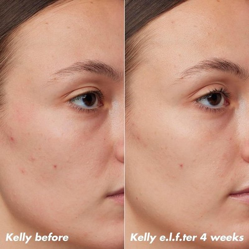 e.l.f. SKIN PLZ Clarify Facial Oil - Acne Treatment & Redness Relief with Salicylic Acid | 1 oz Vegan & Cruelty-Free