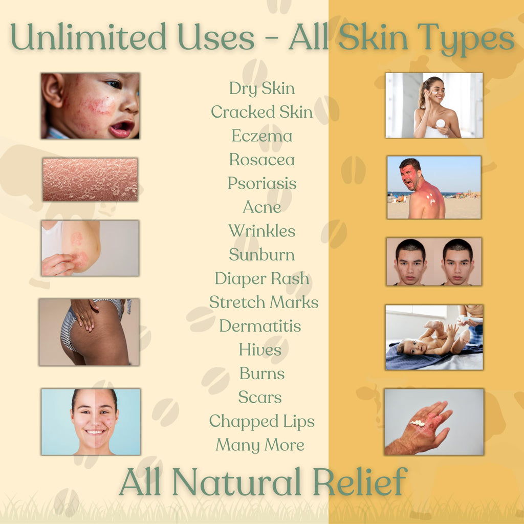 Beef Tallow Balm for Skin -2 Ingredients- Grass-Fed Grass-Finished Beef Tallow & Raw Honey for Skin - Unscented Beef Tallow Honey Balm for Face & Body - Sensitive Dry Skin Eczema Psoriasis Rosacea