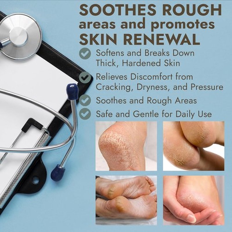 Skiennix Callus Remover Gel - Extra Strength Treatment with Tea Tree Oil | 14 fl oz | 50 Applications + 3 Pumice Stones