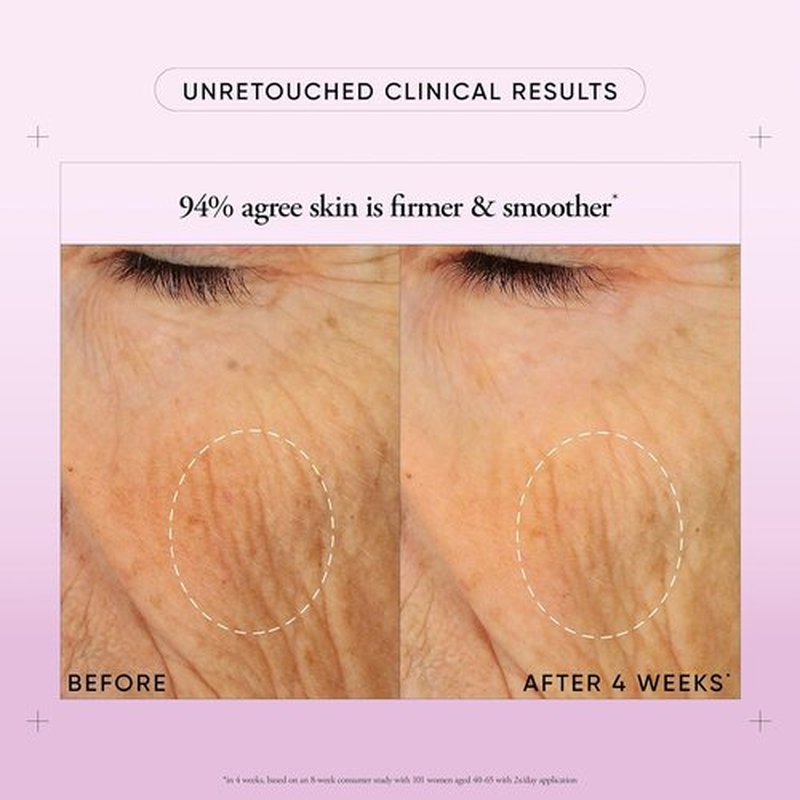Philosophy Ultimate Miracle Worker Face & Neck Cream - Nourishing Retinol & Ceramides - Smooths Fine Lines & Wrinkles