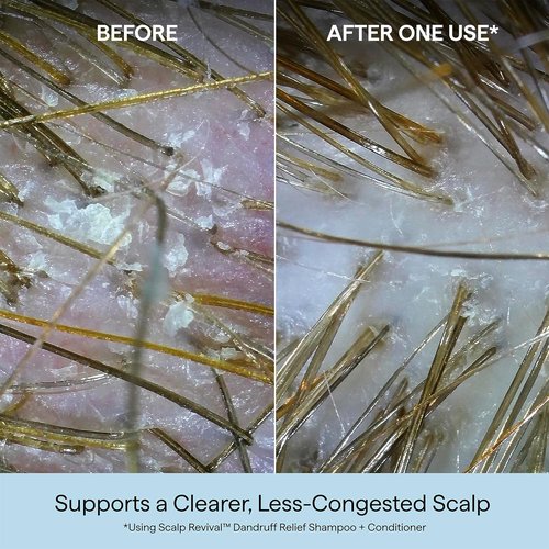 Briogeo Scalp Revival Dandruff Relief Shampoo - Charcoal & 3% Salicylic Acid | Daily Anti-Dandruff Care | 8.4 fl oz
