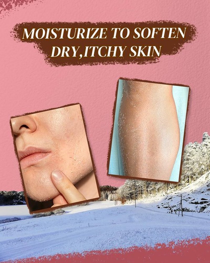 larosanna Australian Lanolin Cream,Natural Lanolin Cream for Itchy Dry Skin,Organic Lanolin Oil Moisturizer for Body and Face,3.53 fl oz