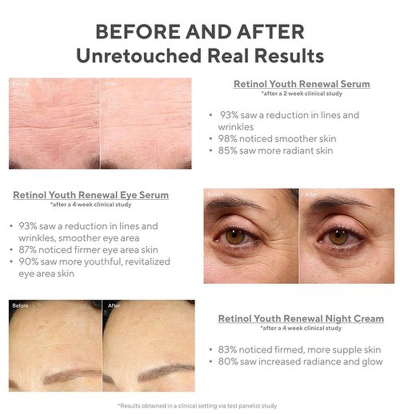 Murad Active Renewal 30-Day Regimen Kit | 5-Piece Trial Set for Youthful Skin Renewal