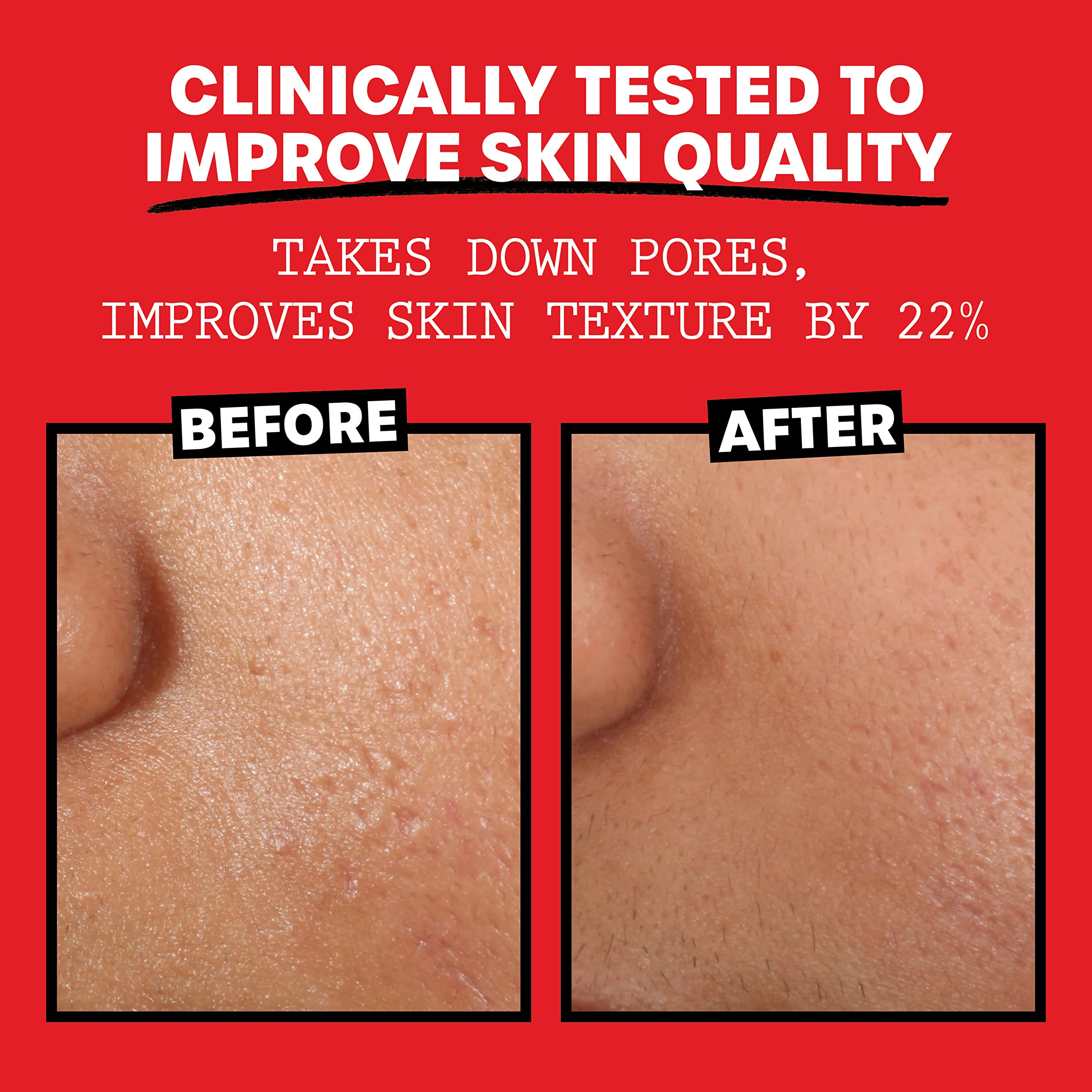 THAYERS Alcohol-Free, Hydrating Rose Petal Witch Hazel Facial Toner with Aloe Vera Formula, Vegan, Dermatologist Tested and Recommended, 12 Oz (Pack of 2)