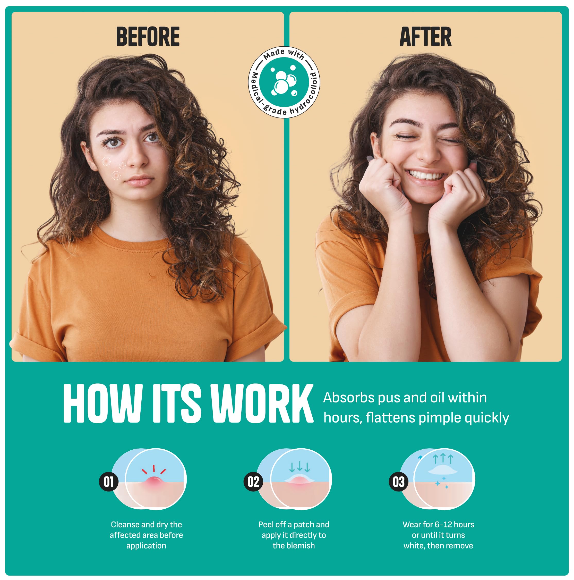 GoGleefy Pimple Patches for Face – Day & Night Acne Patches for Fast Healing, Skin Clarity – Invisible Hydrocolloid Patches, Waterproof Spot Treatment – All Skin Types Zit Patches of 60/120/180