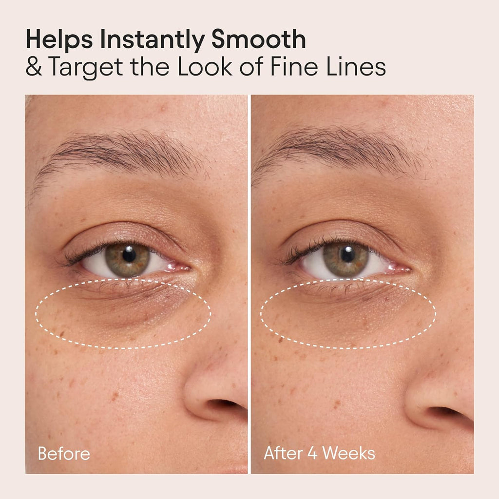 Alpyn Line-Filling Eye Balm - Bakuchiol & Caffeine Formula to Reduce Fine Lines | 0.5 oz / 14 ml