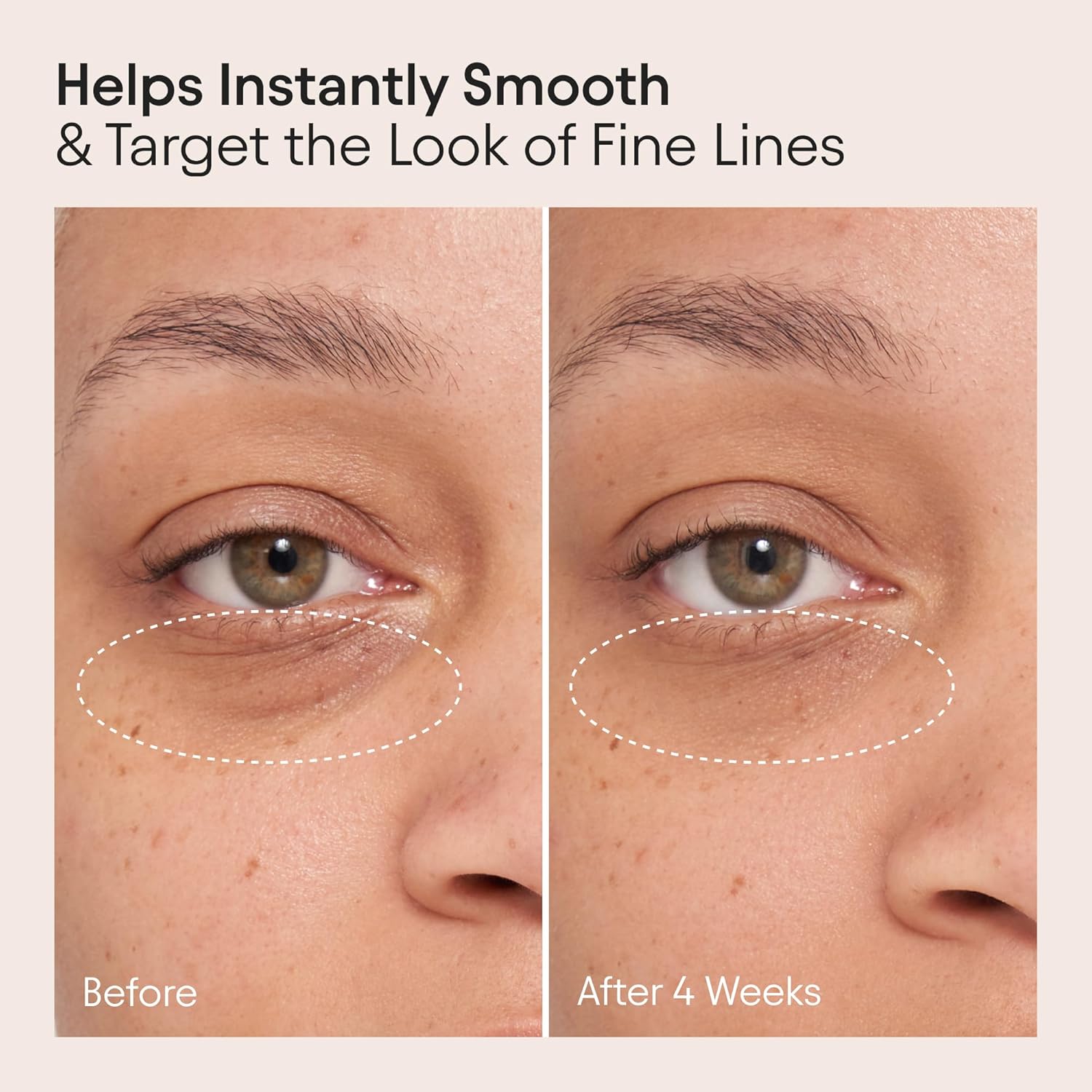 Alpyn Line-Filling Eye Balm - Bakuchiol & Caffeine Formula to Reduce Fine Lines | 0.5 oz / 14 ml