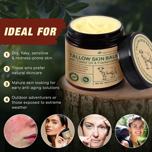 CSDLQNF Beef Tallow Balm with Castor Oil & Frankincense – 100% Grass-Fed Beef Tallow Moisturizer for Face & Body Care – Nourishing Skin Balm to Repair Dry Skin, 4.2 oz