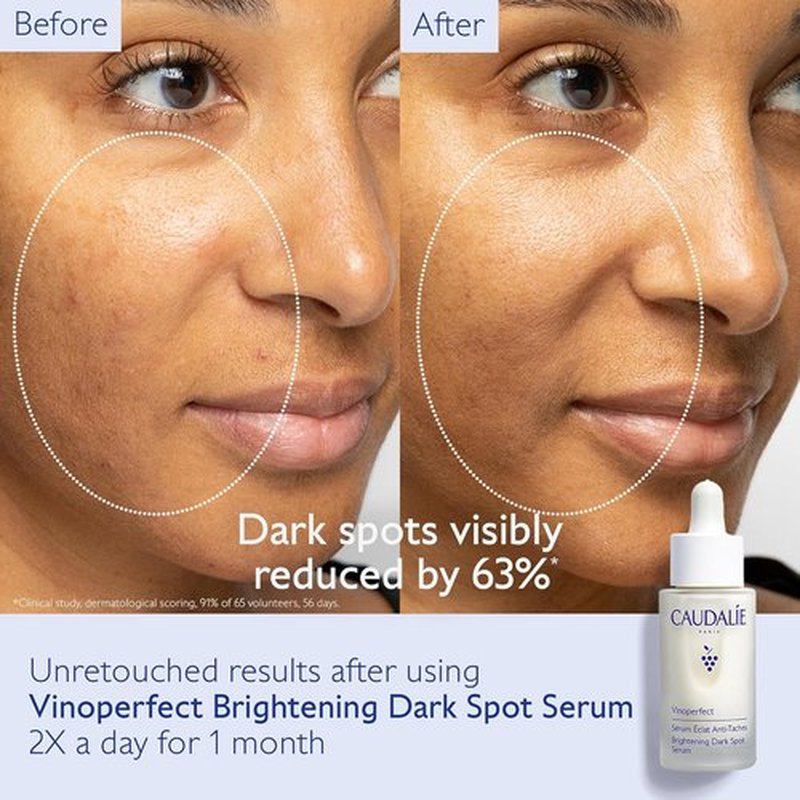 Caudalie Vinoperfect Brightening Dark Spot Serum | Travel Size Grape Water Face Mist