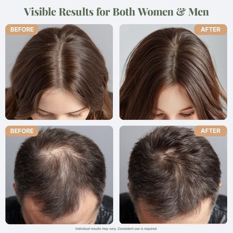 The ÉLIX USDA Organic Rosemary Oil for Hair Growth | Thickening Formula with Castor & Pumpkin Seed | for Hair Loss & Thinning | Made in USA | 4oz