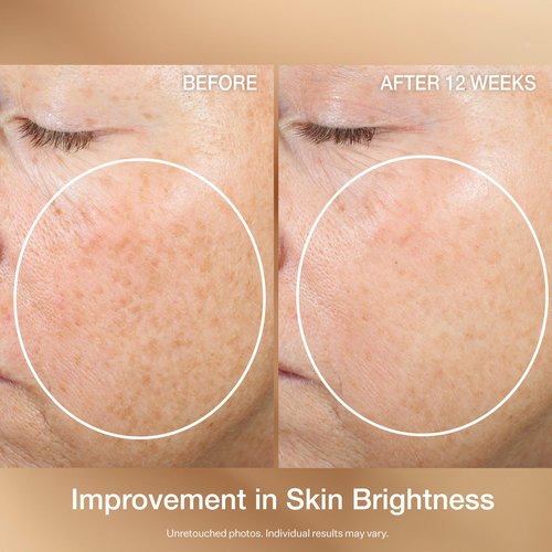StriVectin Multi Action Super C Retinol Brightening & Correcting Serum 1.7oz